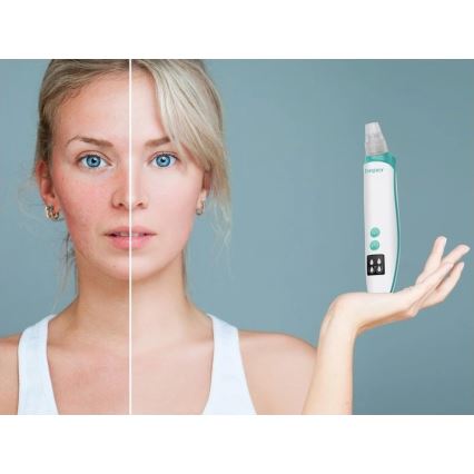 Beper - Punjivi čistač pora USB/5V 400 mAh